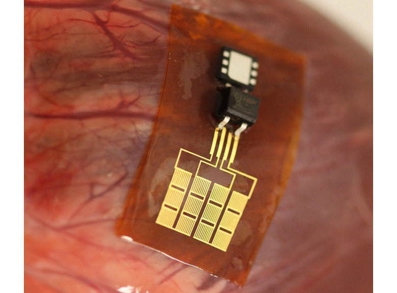 Motion-based energy harvester on a cow's heart