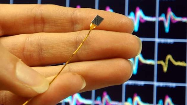 BRAIN IMPLANTS
