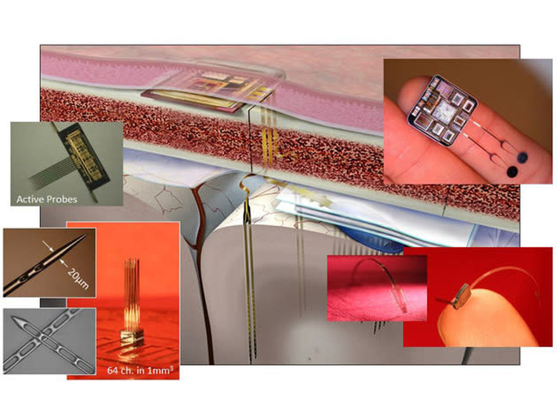 Massachusetts General Hospital brain implant
