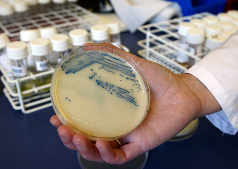 MRSA culture