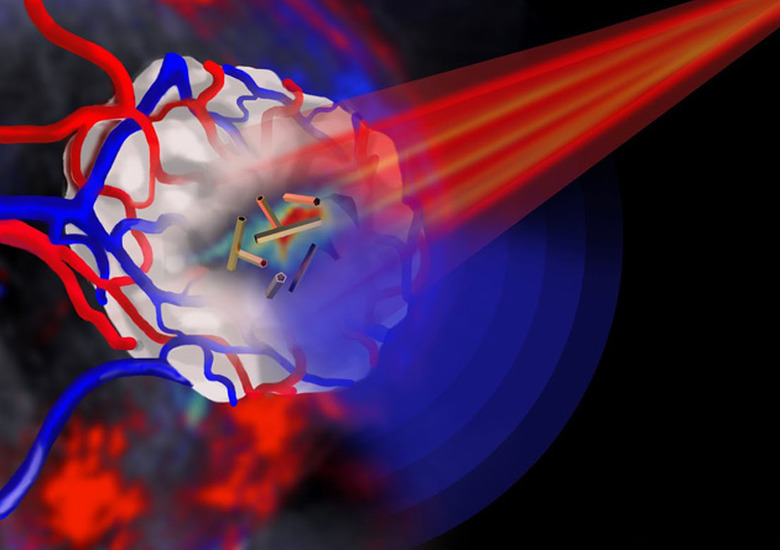 Gold nanotubes in action against cancer cells