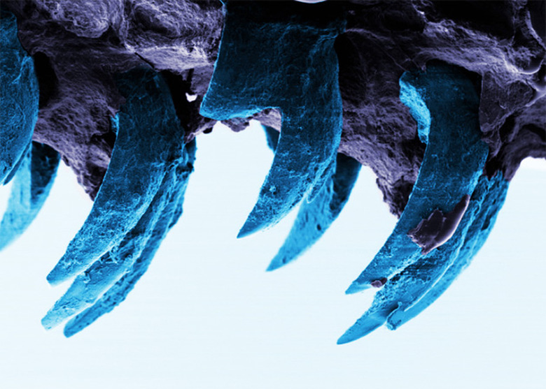 Limpet teeth