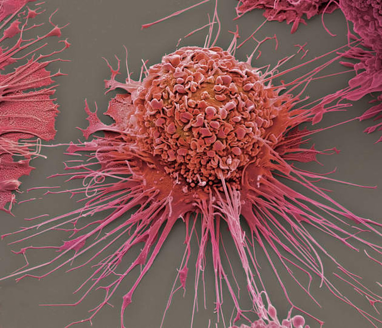 Activated human macrophage, coloured scanning electron micrograph (SEM). Magnification: x2, 700 when printed at 10 centimetres w
