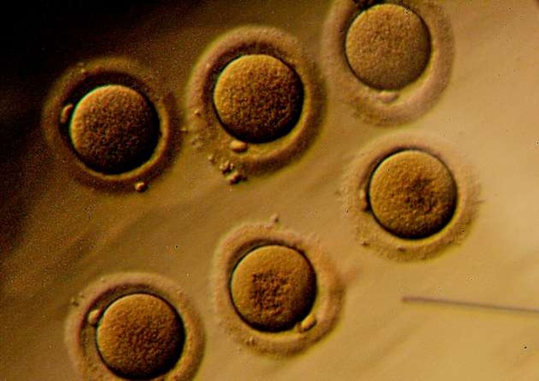 Human embryos on a petri dish are viewed through a microscop