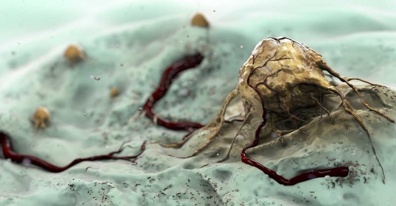 Close up view of a single cancer cell