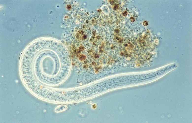 Roundworms (Nematoda), Aschelminthe, seen under microscope