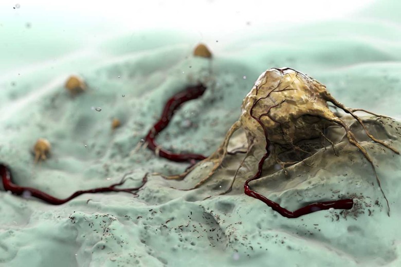 Close up view of a single cancer cell