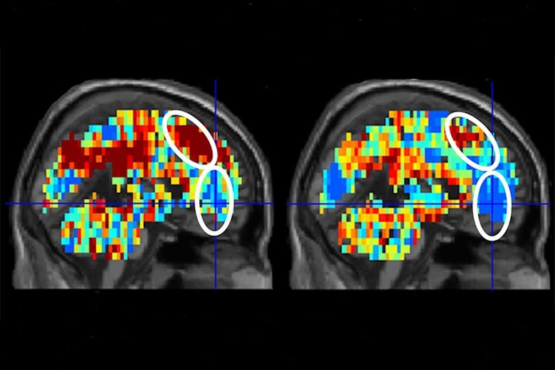On the left is the brain activation pattern for 