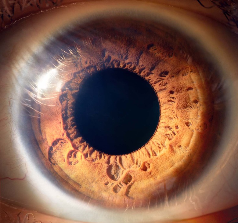 Eye close-up