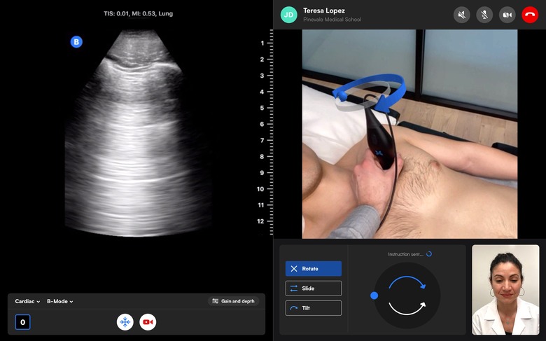 Butterfly Network's ultrasound teleguidance