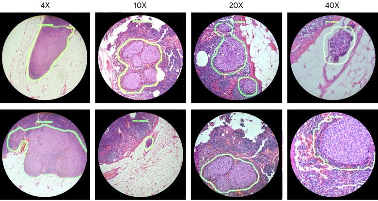 Image from Googles AI microscope