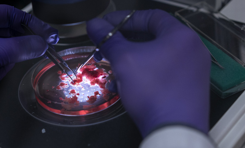 Human brain organoids