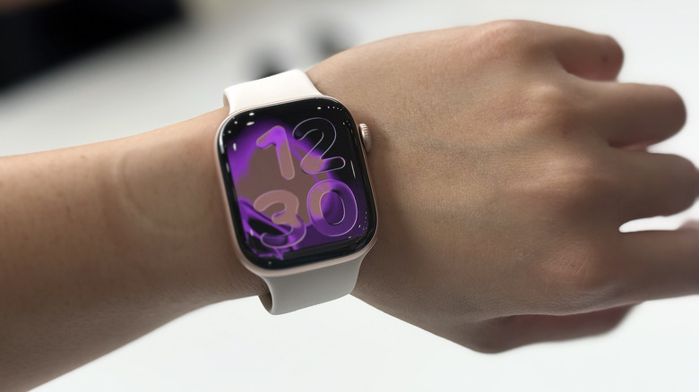 Apple Watch Series 11.