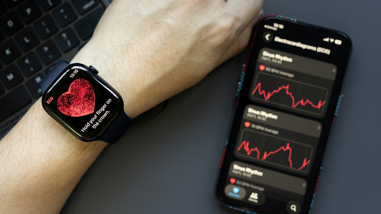 An Apple Watch open to the ECG app with an iPhone in the background showing a chart of results.