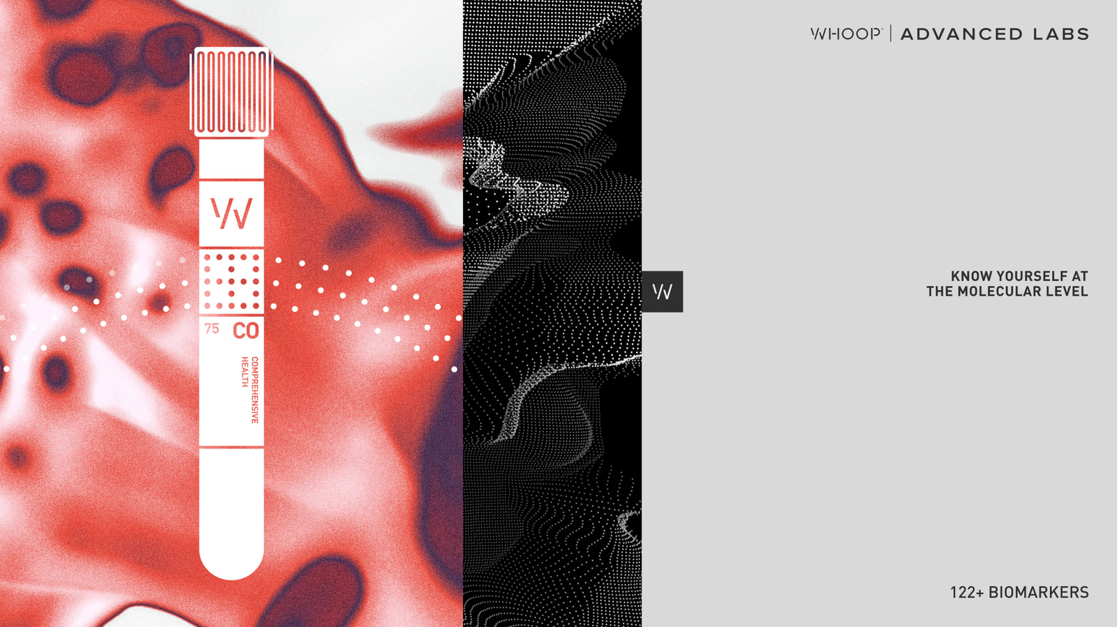 Whoop's Advanced Labs health screenings will no longer require a subscription