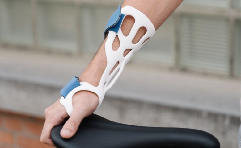 A 3D-printed arm brace