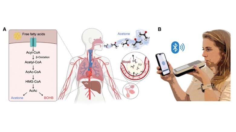 Two illustrations of a human body and a woman measuring her acetone from the Device study.